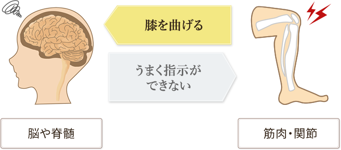 図)痛みが生じている状態